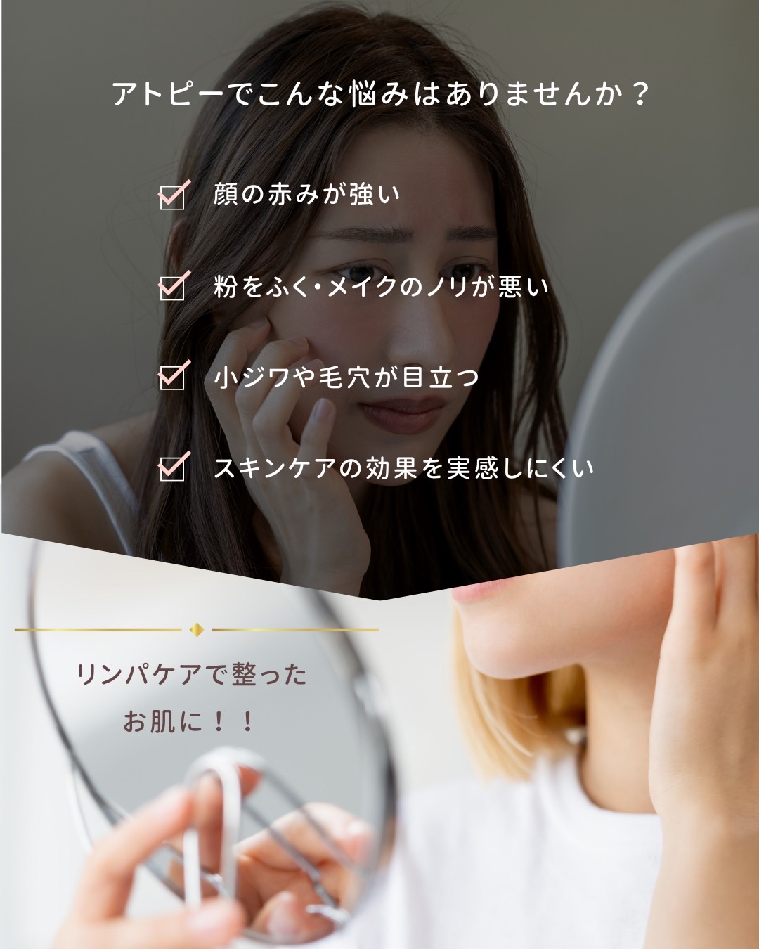 💫 「隠す」より「整える」。アトピー肌の赤みケア法 🌸