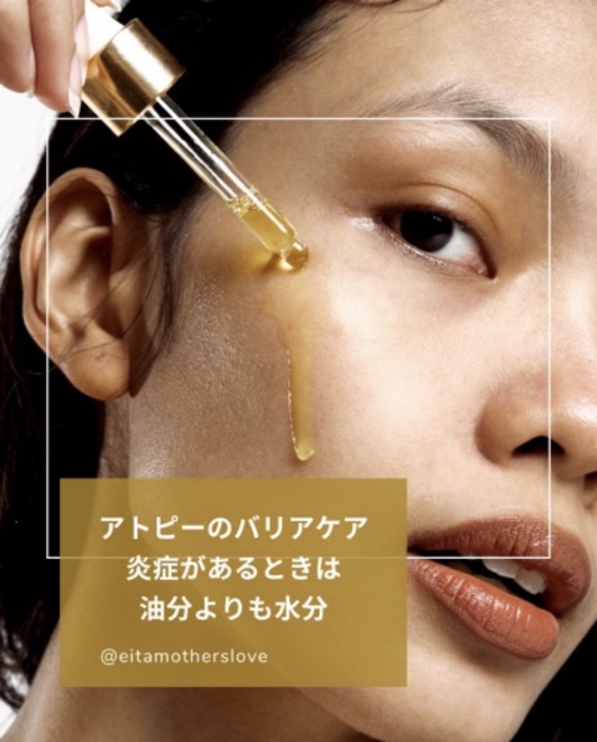 ✨【アトピーさんは“オイル”に気をつけて】